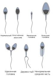spermatozoidy-vidy.jpg